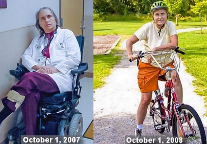 Physician Terry Wahls reversed her multiple sclerosis after adopting a low-carb, high-fat ketogenic Paleo diet. (Photos: Dr. Terry Wahls)