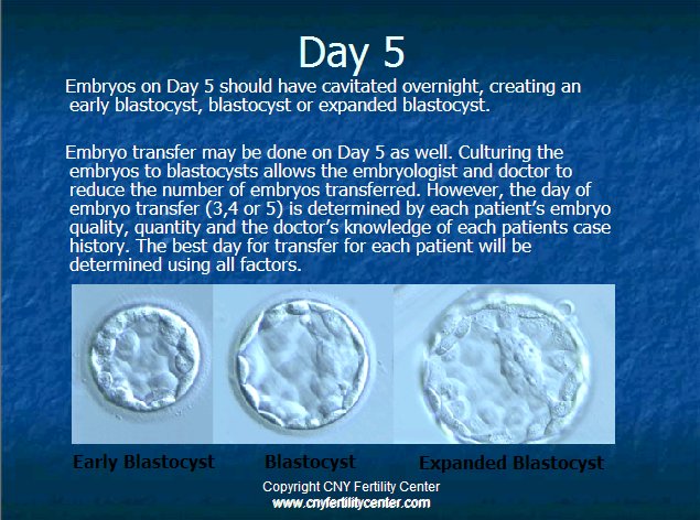 Day 5 embryos