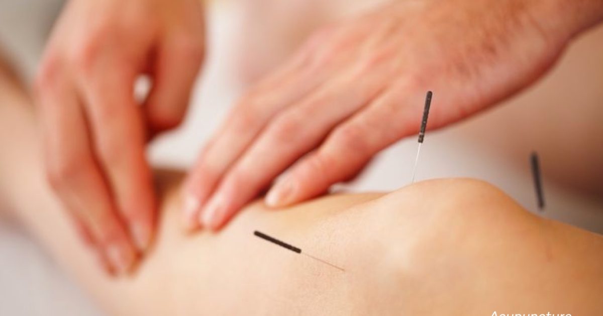 Acupuncture for Fertility Info, Protocols, and Specialist Locator