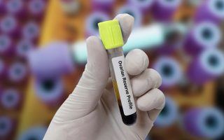 Diminished Ovarian Reserve: Symptoms, Causes, and How It Affects Fertility