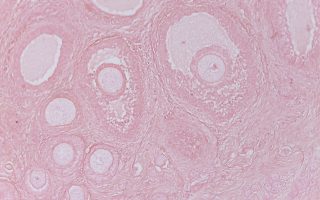 Antral Follicle Count: How Many Follicles Is Good for IVF?