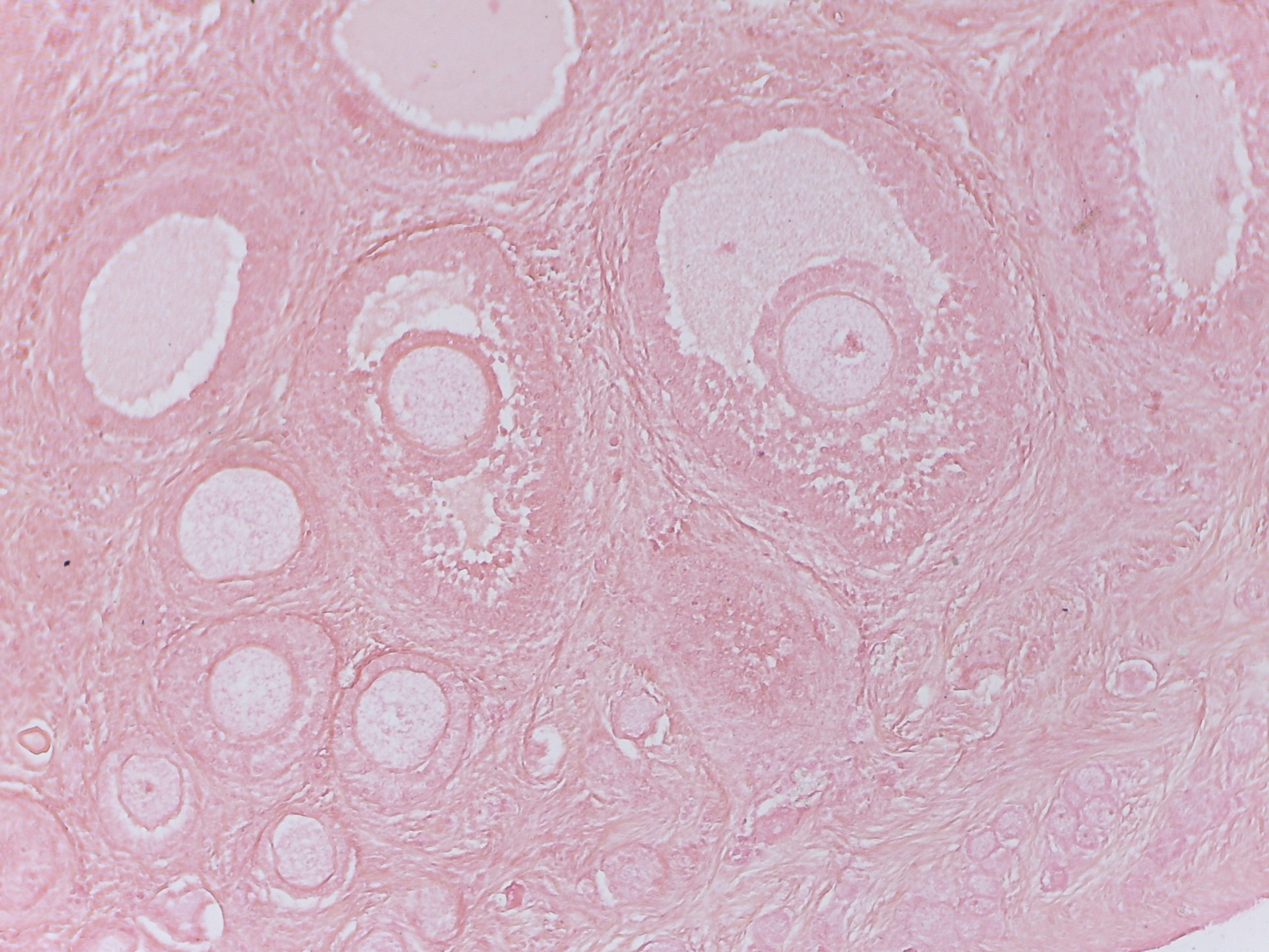 Antral Follicle Count: How Many Follicles Are Good for IVF?