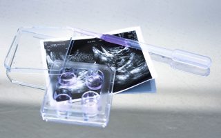 Modified Natural Frozen Embryo Transfer (FET) Cycle: What It Is, How It Works