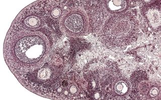 IVF Follicles Explained: Sizes by Day and What Matters