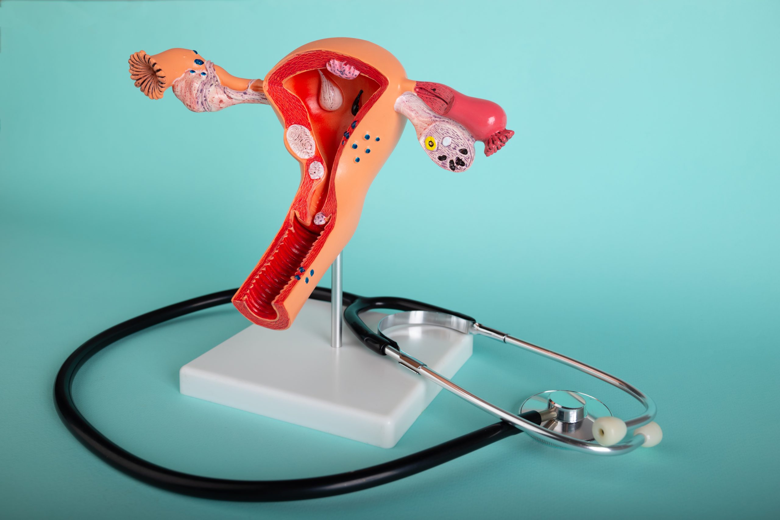 Diagnostic Hysteroscopy: Risks, How to Prepare & What to Expect