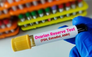 Understanding Ovarian Reserve Testing: What It Is & Why It’s Important