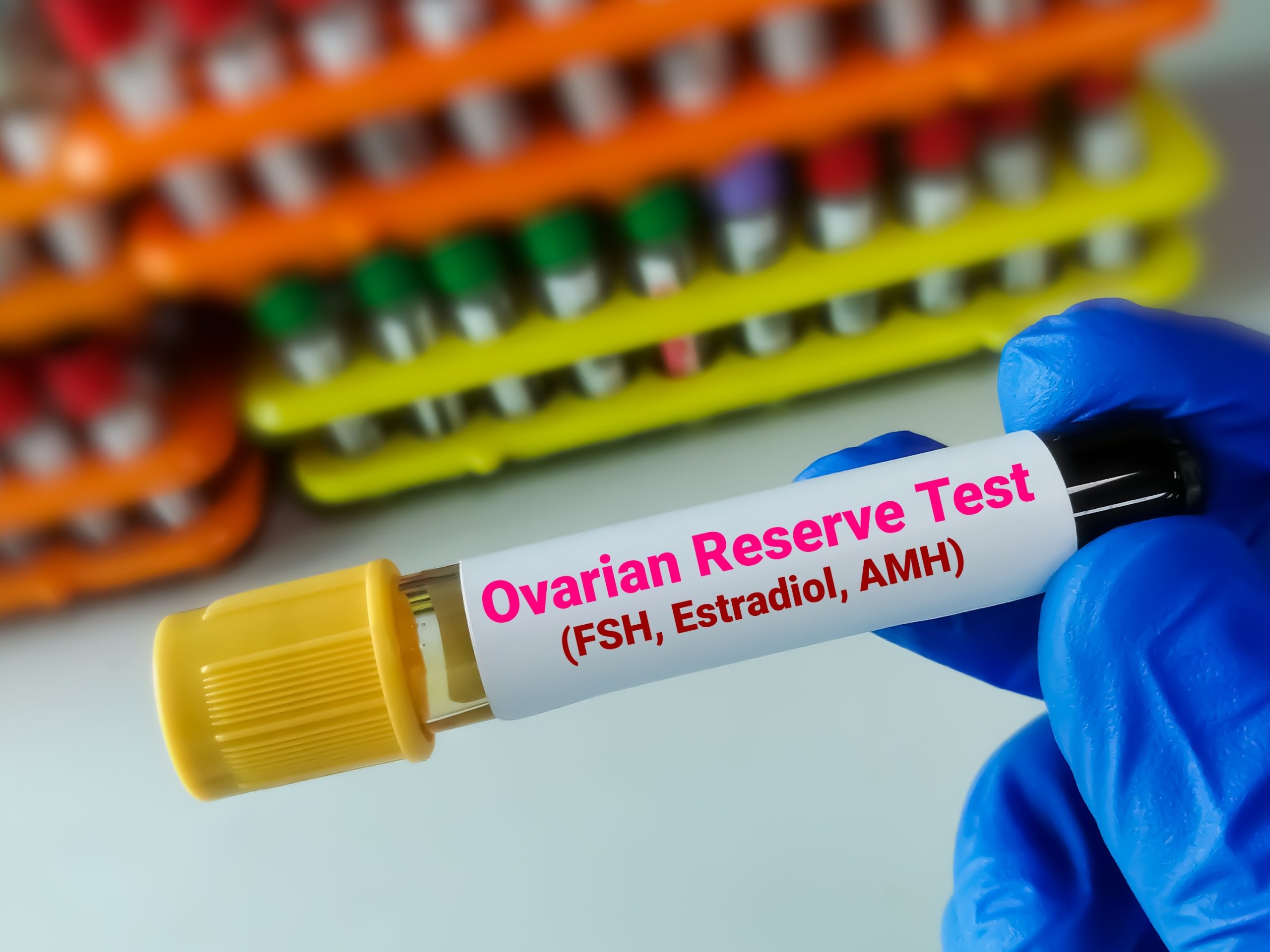 Understanding Ovarian Reserve Testing: What It Is & Why It’s Important
