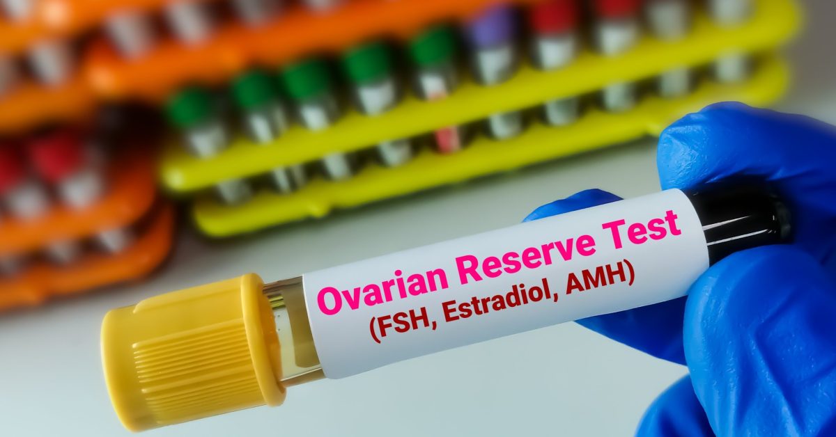 Best Protocols for Poor Ovarian Reserve: What You Need to Know