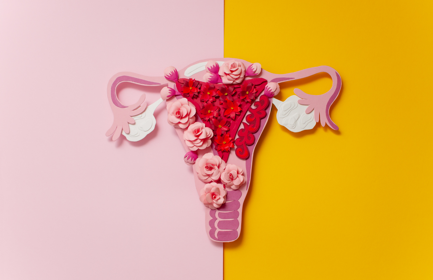 Endometriosis & Infertility How It Causes Infertility and Treatment Options