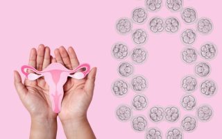 Everything You Need to Know about PCOS and IVF