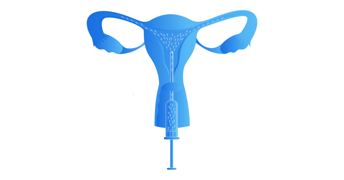 Artificial Insemination Types, Process, Costs and More