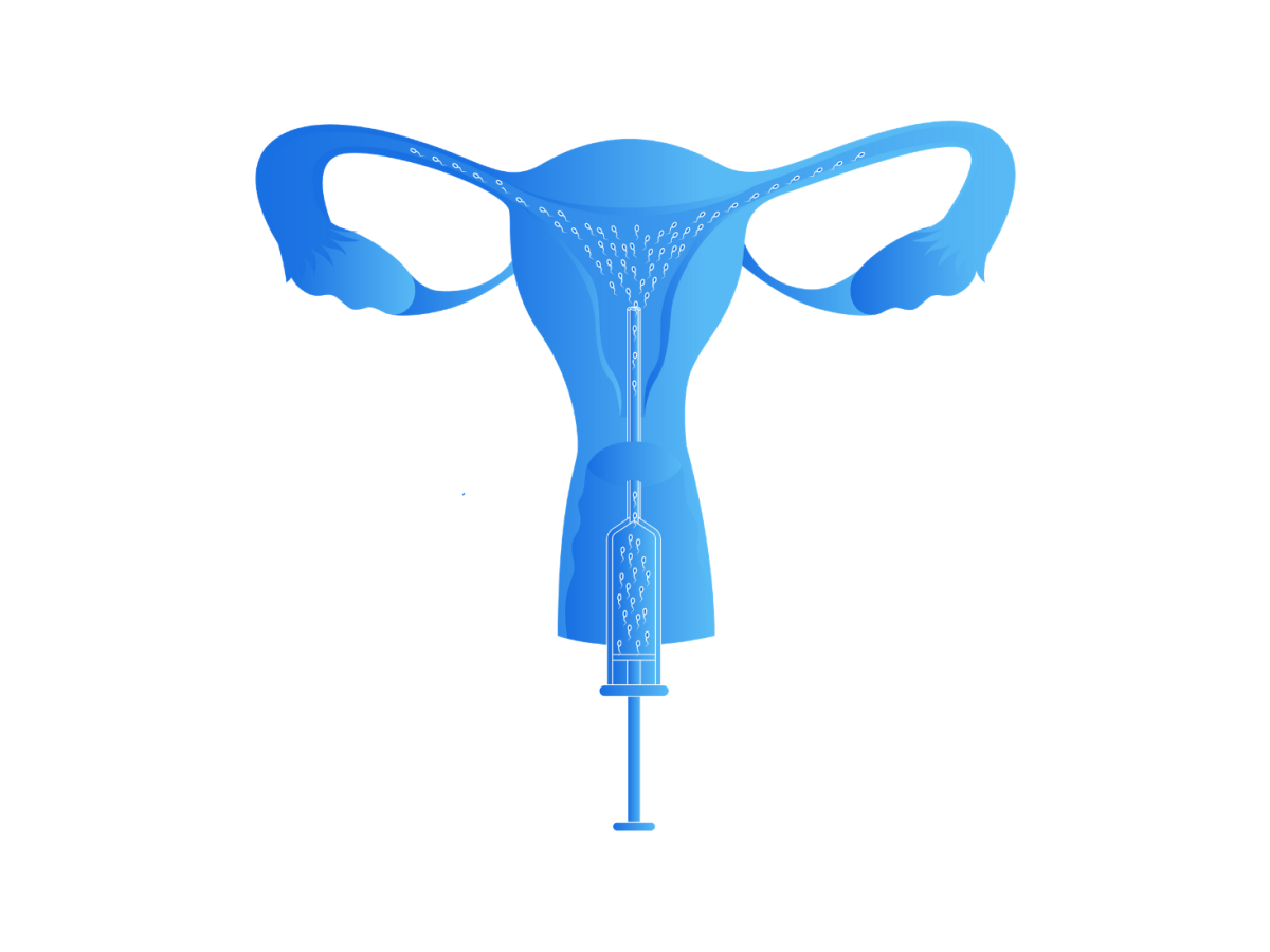 Please confirm how far you can support the artificial insemination cost.