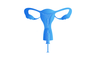 Artificial Insemination: Types, Process, Costs and more
